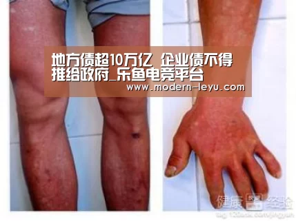 地方债超10万亿 企业债不得推给政府_乐鱼电竞平台